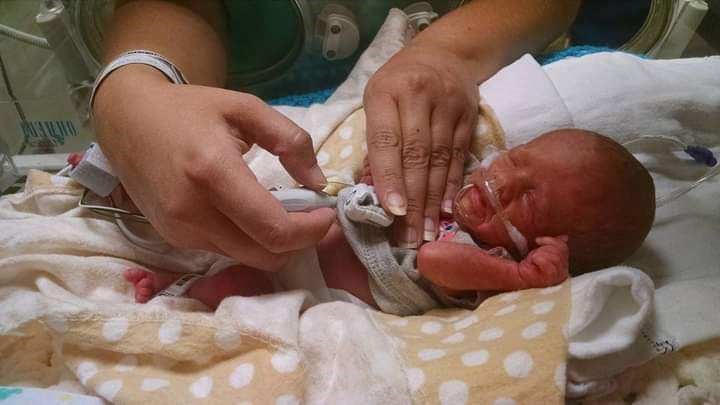 Scarlett Myers weighed 2lbs at birth in 2015.
